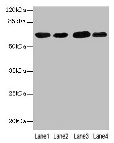 Western blot  | All lanes: ESR1 antibody at 7µg/ml  | Lane 1: Hela whole cell lysate  | Lane 2: MCF-7 whole cell lysate  | Lane 3: Rat brain tissue  | Lane 4: Colo320 whole cell lysate  | Secondary  | Goat polyclonal to rabbit IgG at 1/10000 dilution  | Predicted band size: 67, 54, 48, 36 kDa  | Observed band size: 67 kDaRabbit anti-Human ESR1 Polyclonal Antibody