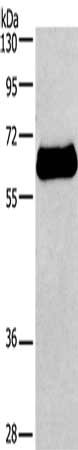 Gel: 10%SDS-PAGE, Lysate: 40 μg, Lane: HepG2 cells, Primary antibody: IL2RB Antibody(IL2RB Antibody) at dilution 1/650, Secondary antibody: Goat anti rabbit IgG at 1/8000 dilution, Exposure time: 40 secondsRabbit anti-Human IL2RB Polyclonal Antibody