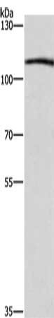 Gel: 6%SDS-PAGE, Lysate: 40 μg, Lane: Raji cells, Primary antibody: COPB1 Antibody(COPB1 Antibody) at dilution 1/350, Secondary antibody: Goat anti rabbit IgG at 1/8000 dilution, Exposure time: 10 secondsRabbit anti-Human COPB1 Polyclonal Antibody