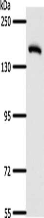 Gel: 8%SDS-PAGE, Lysate: 40 μg, Lane: Human fetal lung tissue, Primary antibody: AFF2 Antibody(AFF2 Antibody) at dilution 1/400, Secondary antibody: Goat anti rabbit IgG at 1/8000 dilution, Exposure time: 1 minuteRabbit anti-Human AFF2 Polyclonal Antibody