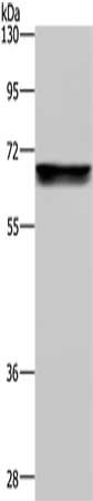 Gel: 8%SDS-PAGE, Lysate: 40μg, Lane: Raji cells, Primary antibody: ACHE Antibody(ACHE Antibody) at dilution 1/250, Secondary antibody: Goat anti rabbit IgG at 1/8000 dilution, Exposure time: 2 minutes
