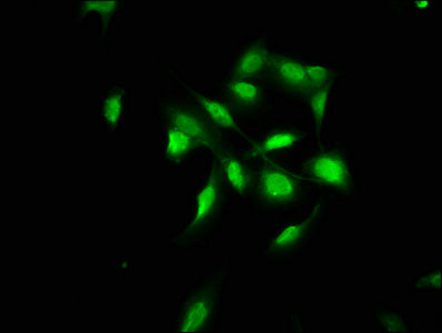 Immunofluorescence staining of U251 cells with the antibody at 1:100, counter-stained with DAPI. The cells were fixed in 4% formaldehyde, permeabilized using 0.2% Triton X-100 and blocked in 10% normal Goat Serum. The cells were then incubated with the antibody overnight at 4°C. The secondary antibody was Alexa Fluor 488-congugated AffiniPure Goat Anti-Rabbit IgG(H+L).Rabbit anti-Human COL4A1 Polyclonal Antibody