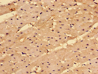 Immunohistochemistry of paraffin-embedded human heart tissue using COL4A1 Antibody at dilution of 1:100Rabbit anti-Human COL4A1 Polyclonal Antibody