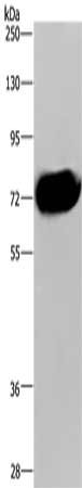 Gel: 8%SDS-PAGE, Lysate: 40 μg, Lane: Human pancreas tissue, Primary antibody: CDC16 Antibody(CDC16 Antibody) at dilution 1/250, Secondary antibody: Goat anti rabbit IgG at 1/8000 dilution, Exposure time: 5 secondsRabbit anti-Human CDC16 Polyclonal Antibody