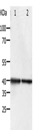 Gel: 10%SDS-PAGE, Lysate: 40 μg, Lane 1-2: Hela cells, Jurkat cells, Primary antibody: PDX1 Antibody(PDX1 Antibody) at dilution 1/450, Secondary antibody: Goat anti rabbit IgG at 1/8000 dilution, Exposure time: 1 minuteRabbit anti-Human PDX1 Polyclonal Antibody