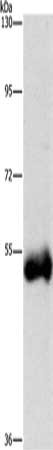 Gel: 6%SDS-PAGE, Lysate: 40 μg, Lane: Human placenta tissue, Primary antibody: CTSC Antibody(CTSC Antibody) at dilution 1/1000, Secondary antibody: Goat anti rabbit IgG at 1/8000 dilution, Exposure time: 2 minutesRabbit anti-Human CTSC Polyclonal Antibody