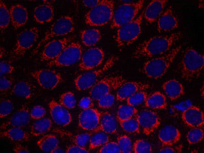 Immunofluorescence staining of methanol-fixed MCF7 cells using HER2(Ab-1248) Antibody.Rabbit anti-Human ERBB2 Polyclonal Antibody