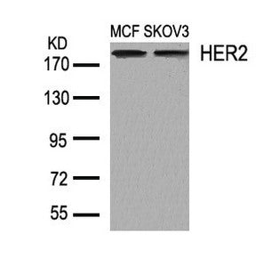 Western blot analysis of extracts from MCF and SKOV3 cells using HER2(Ab-1248) Antibody.Rabbit anti-Human ERBB2 Polyclonal Antibody