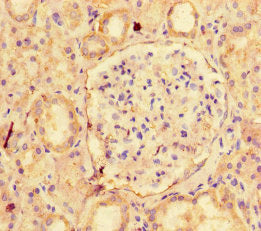 Immunohistochemistry of paraffin-embedded human kidney tissue using NAPSA Antibody at dilution of 1:100Rabbit anti-Human NAPSA Polyclonal Antibody