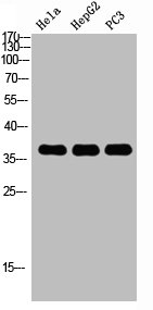 Western Blot analysis of HELA HEPG2 PC-3 using p38 Polyclonal Antibody. Antibody was diluted at 1:1000. Secondary antibody  was diluted at 1:20000