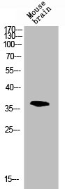 Western blot analysis of mouse-brain lysis using p38 antibody. Antibody was diluted at 1:1000. Secondary antibody  was diluted at 1:20000