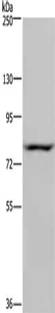 Gel: 6%SDS-PAGE, Lysate: 40 μg, Lane: Hela cells, Primary antibody: NOC2L Antibody(NOC2L Antibody) at dilution 1/200, Secondary antibody: Goat anti rabbit IgG at 1/8000 dilution, Exposure time: 5 secondsRabbit anti-Human NOC2L Polyclonal Antibody