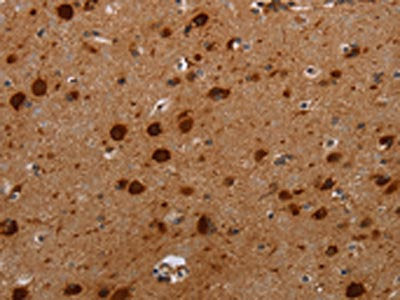 The image on the left is immunohistochemistry of paraffin-embedded Human brain  tissue using MFSD2A Antibody(MFSD2A Antibody) at dilution 1/25, on the right is treated with synthetic peptide. (Original magnification: ×200)Rabbit anti-Human MFSD2A Polyclonal Antibody