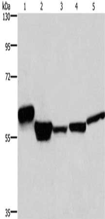 Gel: 8%SDS-PAGE, Lysate: 40 μg, Lane 1-5: Human thyroid cancer tissue, mouse liver tissue, human fetal liver tissue, A549 cells, 293T cells, Primary antibody: MFSD2A Antibody(MFSD2A Antibody) at dilution 1/300, Secondary antibody: Goat anti rabbit IgG at 1/8000 dilution, Exposure time: 1 minuteRabbit anti-Human MFSD2A Polyclonal Antibody