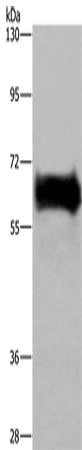 Gel: 6%SDS-PAGE, Lysate: 40 μg, Lane: Mouse kidney tissue, Primary antibody: EZR Antibody(EZR Antibody) at dilution 1/300, Secondary antibody: Goat anti rabbit IgG at 1/8000 dilution, Exposure time: 30 secondsRabbit anti-Human EZR Polyclonal Antibody