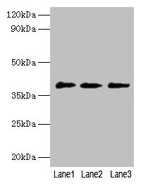 Western blot  | All lanes: POU5F1 antibody at 2µg/ml  | Lane 1: Jurkat whole cell lysate  | Lane 2: Hela whole cell lysate  | Lane 3: 293T whole cell lysate  | Secondary  | Goat polyclonal to rabbit IgG at 1/10000 dilution  | Predicted band size: 39, 31 kDa  | Observed band size: 39 kDaRabbit anti-Human POU5F1 Polyclonal Antibody