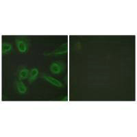 Immunofluorescence analysis of HeLa cells, using PECAM-1 (Ab-713) antibody.Rabbit anti-Human PECAM1 Polyclonal Antibody