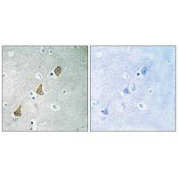 Immunohistochemistry analysis of paraffin-embedded human brain tissue using PECAM-1 (Ab-713) antibody.Rabbit anti-Human PECAM1 Polyclonal Antibody