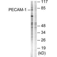 Western blot analysis of extracts from Jurkat cells, using PECAM-1 (Ab-713) antibody.Rabbit anti-Human PECAM1 Polyclonal Antibody