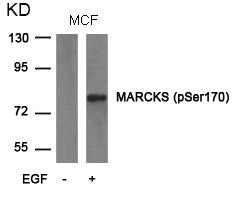 Western blot analysis of extracts from MCF cells untreated or treated with EGF using MARCKS(phospho-Ser170) Antibody.
