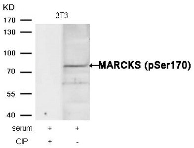 Western blot analysis of extracts from 3T3 cells, treated with serum or calf intestinal phosphatase (CIP), using MARCKS (phospho-Ser170) Antibody.
