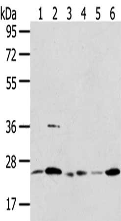 Gel: 8%SDS-PAGE,Lysate: 40 μg,Lane 1-6: 231 cells, A431 cells, Mouse liver tissue, Human placenta tissue, Jurkat cells, Raji cells,Primary antibody: PSMB8 Antibody(PSMB8 Antibody) at dilution 1/350 dilution,Secondary antibody: Goat anti rabbit IgG at 1/8000 dilution,Exposure time: 10 secondsRabbit anti-Human PSMB8 Polyclonal Antibody