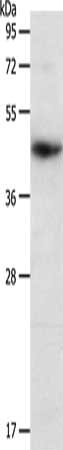 Gel: 10%SDS-PAGE, Lysate: 40 μg, Lane: Hela cells, Primary antibody: PDCD2 Antibody(PDCD2 Antibody) at dilution 1/200, Secondary antibody: Goat anti rabbit IgG at 1/8000 dilution, Exposure time: 20 secondsRabbit anti-Human PDCD2 Polyclonal Antibody