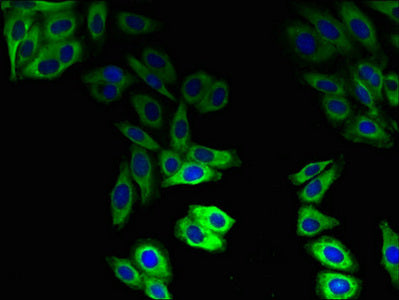 Immunofluorescent analysis of HepG2 cells using ABCB1 Antibody at dilution of 1:100 and Alexa Fluor 488-congugated AffiniPure Goat Anti-Rabbit IgG(H+L)