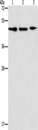 Gel: 12%SDS-PAGE, Lysate: 40 μg, Lane 1-3: PC3 cells, Jurkat cells, Raji cells, Primary antibody: APOBEC3G Antibody(APOBEC3G Antibody) at dilution 1/240, Secondary antibody: Goat anti rabbit IgG at 1/8000 dilution, Exposure time: 30 secondsRabbit anti-Human APOBEC3G Polyclonal Antibody