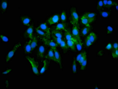 Immunofluorescence staining of Hela cells with TGM2 Antibody at 1:133, counter-stained with DAPI. The cells were fixed in 4% formaldehyde, permeabilized using 0.2% Triton X-100 and blocked in 10% normal Goat Serum. The cells were then incubated with the antibody overnight at 4°C. The secondary antibody was Alexa Fluor 488-congugated AffiniPure Goat Anti-Rabbit IgG(H+L).Rabbit anti-Human TGM2 Polyclonal Antibody