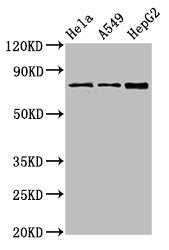 Western Blot  | Positive WB detected in: Hela whole cell lysate, A549 whole cell lysate, HepG2 whole cell lysate  | All lanes: TGM2 antibody at 4µg/ml  | Secondary  | Goat polyclonal to rabbit IgG at 1/50000 dilution  | Predicted band size: 78, 62, 39 kDa  | Observed band size: 78 kDaRabbit anti-Human TGM2 Polyclonal Antibody