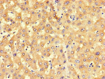 Immunohistochemistry of paraffin-embedded human liver tissue using BHMT2 Antibody at dilution of 1:100