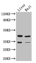 Western Blot  | Positive WB detected in: Mouse liver tissue, Raji whole cell lysate  | All lanes: BHMT2 antibody at 3µg/ml  | Secondary  | Goat polyclonal to rabbit IgG at 1/50000 dilution  | Predicted band size: 41, 34 kDa  | Observed band size: 41, 34 kDa