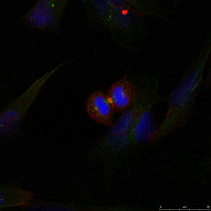 Immunofluorescence staining of methanol-fixed Hela cells using b-Catenin(Ab-37) Antibody.Rabbit anti-Human CTNNB1 Polyclonal Antibody