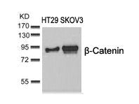 Western blot analysis of extracts from HT29 and SKOV3 cells using b-Catenin(Ab-37) Antibody.Rabbit anti-Human CTNNB1 Polyclonal Antibody