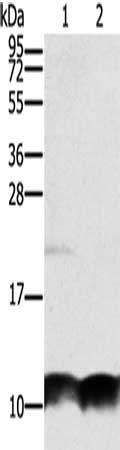 Gel: 8%SDS-PAGE, Lysate: 40 μg, Lane 1-2: Hela cells, mouse liver tissue, Primary antibody: UBB Antibody(UBB Antibody) at dilution 1/300, Secondary antibody: Goat anti rabbit IgG at 1/8000 dilution, Exposure time: 40 secondsRabbit anti-Human UBB Polyclonal Antibody