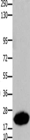Gel: 10%SDS-PAGE, Lysate: 30 μg, Lane: Human liver cancer tissue, Primary antibody: CLDN7 Antibody(CLDN7 Antibody) at dilution 1/1050, Secondary antibody: Goat anti rabbit IgG at 1/8000 dilution, Exposure time: 40 secondsRabbit anti-Human CLDN7 Polyclonal Antibody