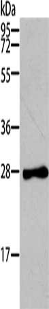 Gel: 12%SDS-PAGE, Lysate: 40 μg, Lane: Mouse heart tissue, Primary antibody: TNNI3 Antibody(TNNI3 Antibody) at dilution 1/200, Secondary antibody: Goat anti rabbit IgG at 1/8000 dilution, Exposure time: 10 secondsRabbit anti-Human TNNI3 Polyclonal Antibody