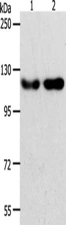 Gel: 8%SDS-PAGE, Lysate: 40 μg, Lane 1-2: Hela cells, Jurkat cells, Primary antibody: ABL2 Antibody(ABL2 Antibody) at dilution 1/400, Secondary antibody: Goat anti rabbit IgG at 1/8000 dilution, Exposure time: 2 minutes