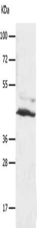 Gel: 10+12%SDS-PAGE, Lysate: 30 μg, Lane: A549 cells, Primary antibody: SLC16A7 Antibody(SLC16A7 Antibody) at dilution 1/450, Secondary antibody: Goat anti rabbit IgG at 1/8000 dilution, Exposure time: 20 secondsRabbit anti-Human SLC16A7 Polyclonal Antibody