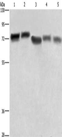 Gel: 6%SDS-PAGE, Lysate: 40 μg, Lane 1-5: Hela cells, human brain tissue, 293T cells, human hepatocellular carcinoma tissue, NIH/3T3 cells, Primary antibody: RDX Antibody(RDX Antibody) at dilution 1/600, Secondary antibody: Goat anti rabbit IgG at 1/8000 dilution, Exposure time: 5 secondsRabbit anti-Human RDX Polyclonal Antibody