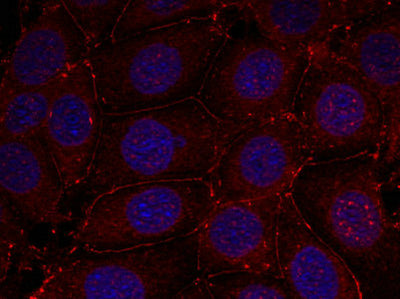 Immunofluorescence staining of methanol-fixed MCF7 cells using IGF-1R (phospho-Tyr1161) antibody.Rabbit anti-Human IGF1R Polyclonal Antibody