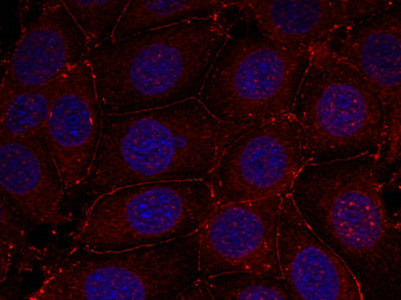 Immunofluorescence staining of methanol-fixed MCF7 cells using IGF-1R (phospho-Tyr1161) antibody.Rabbit anti-Human IGF1R Polyclonal Antibody