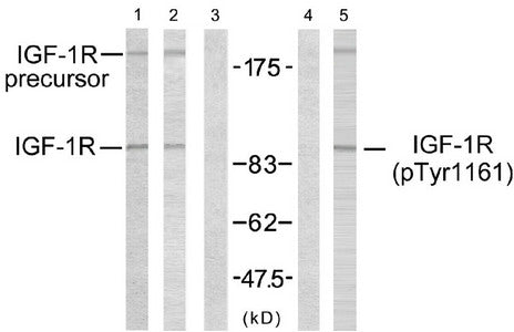 Western blot analysis using IGF-1R (Ab-1161) antibody (Line 1, 2 and 3) and IGF-1R (phospho-Tyr1161) antibody (Line 4 and 5).Rabbit anti-Human IGF1R Polyclonal Antibody