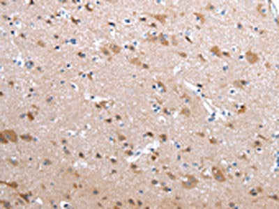 The image on the left is immunohistochemistry of paraffin-embedded Human brain tissue using the antibody Antibody) at dilution 1/20, on the right is treated with synthetic peptide. (Original magnification: ×200)Rabbit anti-Human CFC1 Polyclonal Antibody