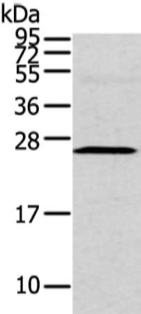 Gel: 12%SDS-PAGE, Lysate: 40 μg, Lane: Human fetal intestines tissue, Primary antibody: CFC1 Antibody(CFC1 Antibody) at dilution 1/200 dilution, Secondary antibody: Goat anti rabbit IgG at 1/8000 dilution, Exposure time: 2 minutesRabbit anti-Human CFC1 Polyclonal Antibody