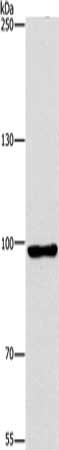 Gel: 6%SDS-PAGE, Lysate: 40 μg, Lane: NIH/3T3 cells, Primary antibody: PIWIL3 Antibody(PIWIL3 Antibody) at dilution 1/200, Secondary antibody: Goat anti rabbit IgG at 1/8000 dilution, Exposure time: 2 minutesRabbit anti-Human PIWIL3 Polyclonal Antibody