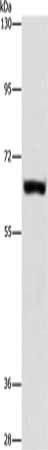 Gel: 6%SDS-PAGE, Lysate: 40 μg, Lane: Human plancenta tissue, Primary antibody: ARSF Antibody(ARSF Antibody) at dilution 1/200, Secondary antibody: Goat anti rabbit IgG at 1/8000 dilution, Exposure time: 30 secondsRabbit anti-Human ARSF Polyclonal Antibody