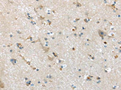 The image on the left is immunohistochemistry of paraffin-embedded Human brain tissue using CD63 Antibody(CD63 Antibody) at dilution 1/35, on the right is treated with synthetic peptide. (Original magnification: ×200)Rabbit anti-Human CD63 Polyclonal Antibody