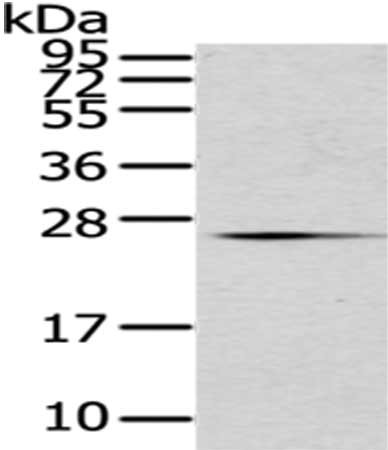 Gel: 12%SDS-PAGE,Lysate: 40 μg,,Primary antibody: CD63 Antibody(CD63 Antibody) at dilution 1/200 dilution,Secondary antibody: Goat anti rabbit IgG at 1/8000 dilution,Exposure time: 2 minutesRabbit anti-Human CD63 Polyclonal Antibody